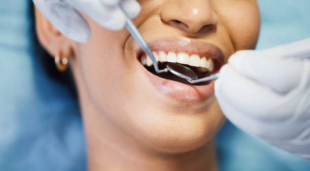 Best Emergency Treatment for Oral Infections in Toronto, OH